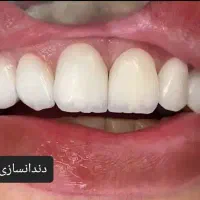 کامپوزیت *vip*|خدمات آرایشگری و زیبایی|خرم‌آباد, |دیوار