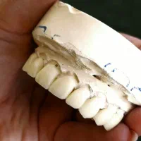 لابراتوار دندان سازی