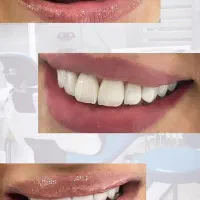 خدمات دندانپزشکی با اقساط ویژه