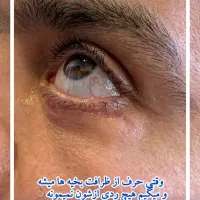 دستیار و اد جراحی زیبایی ، کارشناس اتاق عمل|خدمات آرایشگری و زیبایی|تهران, مرزداران|دیوار