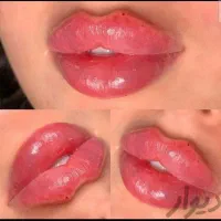 کلینیک تزریق ژل بوتاکس آنزیم فیلر لب شقیقه|خدمات آرایشگری و زیبایی|کرج, گوهردشت|دیوار