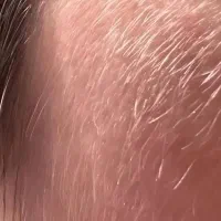ازبین بردن موهای سفیدوکرکی بابلچینگ/تخفیف ویژه