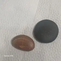 سنگ کلکسیونی و درمانی