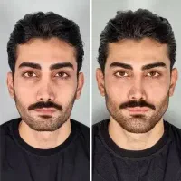 جشنواره تخفیفی کلینیک زیبایی