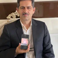 کاشت موی تخصصی تبریز|خدمات آرایشگری و زیبایی|اردبیل, |دیوار