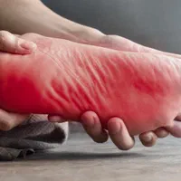 درمان بی حسی و سردی پای دیابتی|خدمات آرایشگری و زیبایی|رشت, منظریه|دیوار