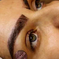 کاشت مو و ابرو باجدیدترین تکنیک های کاشت در لرستان