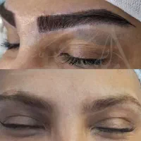 کاشت مو و ابرو با تراکم بالا آف تا آخر ماه