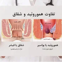 بواسیر شقاق یبوست