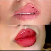 کلینیک بهراد انجام تمامی کارهای زیبایی نقد ‌اقساط