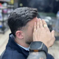 پروتز مو وارداتی با خط رویش عالی