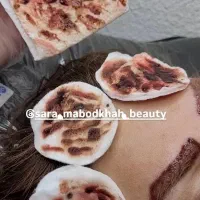 ریمووپاک کردن تتوتاتوابروصورت بدن