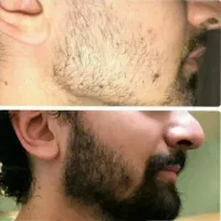 جذابیت/اصالت/پرپشت شو