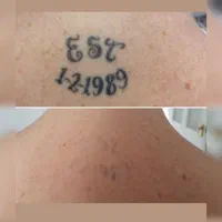 پاک کردن تتو .لیزر.پاککردن خالکوبی .ریموو تتو.prp|خدمات آرایشگری و زیبایی|اصفهان, خلجا|دیوار