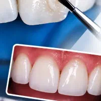آموزش کامپوزیت به صورت خصوصی