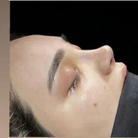 عمل زیبای بینی|خدمات آرایشگری و زیبایی|قائم‌شهر, |دیوار