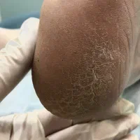خدمات vipپدیکور