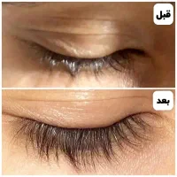 تقویت مژه|آرایشی، بهداشتی، درمانی|تهران, زرکش|دیوار