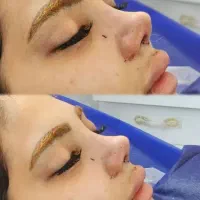 آف جراحی بینی فقط ۲۲اهواز