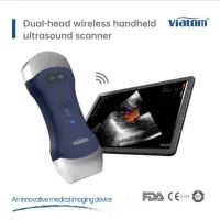 سونوگرافی وایرلس کمپانی Viatom|پزشکی|تهران, پونک|دیوار