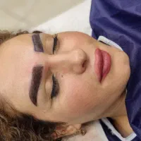 مدل کاشت ابرومیکروکاشت ۱۱۵۰۰