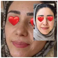 با این کرم دوباره جوان شو