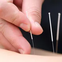 دوره تخصصی طب سوزنی با ارائه مدرک بین‌المللی|خدمات آموزشی|تهران, پیروزی|دیوار