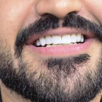 جشنواره دندانپزشکی اقساطی بدون پیش پرداخت|خدمات آرایشگری و زیبایی|شیراز, ستارخان|دیوار