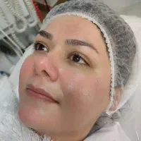 فیشیال صورت آقایان و خانم ها مطب دکترپروین گودرزی