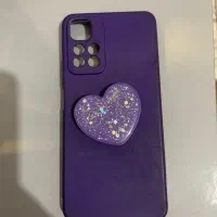 قاب گوشی نوت ۱۱ پرو پلاس|لوازم جانبی موبایل و تبلت|ارومیه, |دیوار