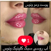 کلینیک تزریق ژل لبM 390بوتاکس لیزر لیفت متدMDCode|خدمات آرایشگری و زیبایی|تهران, صادقیه|دیوار