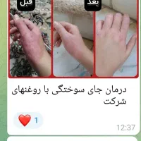 درمانگری باضمانت|خدمات آموزشی|محمدیه-قزوین, |دیوار