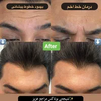 بوتاکس ژل آنزیم نخ لاغری بوتاکس 650 ژل اودری 450|خدمات آرایشگری و زیبایی|قم, هفت تیر|دیوار