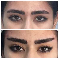 تزریق فیلر بوتاکس و لیفت افتادگی صورت و چشم|خدمات آرایشگری و زیبایی|شیراز, عفیف‌آباد|دیوار