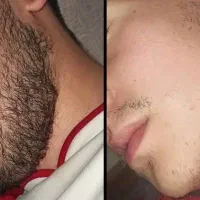 با نداشتن ریش خداحافظی کن