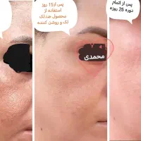 انواع محصولات گیاهی درمانی و زیبایی صورت و بدن