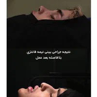 جراحی زیبایی اقساط|خدمات آرایشگری و زیبایی|تهران, امیریه|دیوار