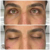 جشنواره  زیبایی کلینیک دکتر محمودی|خدمات آرایشگری و زیبایی|کرمان, |دیوار