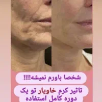 انتخابی هوشمندانه برای پوست و مو