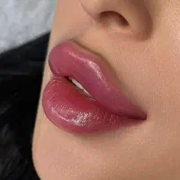 فیلرلب ژل بوتاکس لیزر کاشت مو کاشت ابرو تزریق چربی