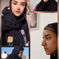 جراح بینی مازندران دکتر اسدالله پور ۲۵میلیون|خدمات آرایشگری و زیبایی|قائم‌شهر, |دیوار