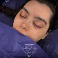 عمل جراحی بینی نئو نوز