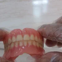 ساخت دندان مصنوعی متحرک|خدمات آرایشگری و زیبایی|صدرا-فارس, |دیوار