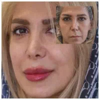 تزریق انواع بوتاکس ،ژل،مزوتراپی ،نخ.انزیم|خدمات آرایشگری و زیبایی|مشهد, سرافرازان|دیوار