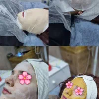 فیشیال تخصصی توسط پیراپزشک با۳۰٪تخفیف درکلینیک|خدمات آرایشگری و زیبایی|شیراز, خلدبرین|دیوار