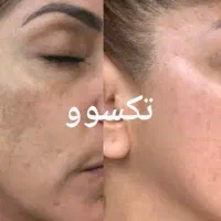 تناسب اندام و زیبایی|آرایشی، بهداشتی، درمانی|شیراز, حافظیه|دیوار