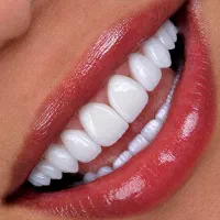 ایمپلنت فوری / اقساط ۲۴ ماه/ دندانپزشکی/بدون سود