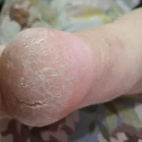 پدیکور و مانیکور|خدمات آرایشگری و زیبایی|اصفهان, باتون|دیوار