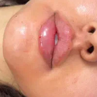 ژل و بوتاکس/ ژل لب/کانتورینگ عربی/روسی|خدمات آرایشگری و زیبایی|فردیس, فردیس|دیوار