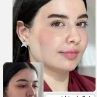 جشنواره زیبایی((مدل ژل وبوتاکس))|خدمات آرایشگری و زیبایی|سنندج, |دیوار